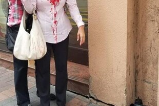 2019 9 24 hongkong practitioner attacked 01